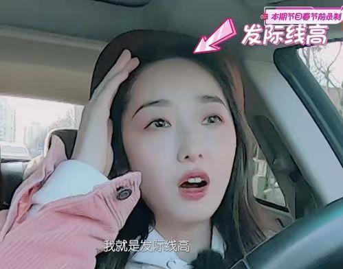 有哪些明星头发秃顶,秃顶明星发际线