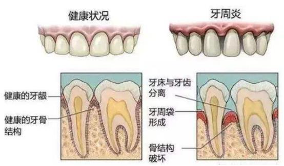 孩子用电动牙刷有哪些危害,超声波的电动牙刷能刷干净牙齿吗
