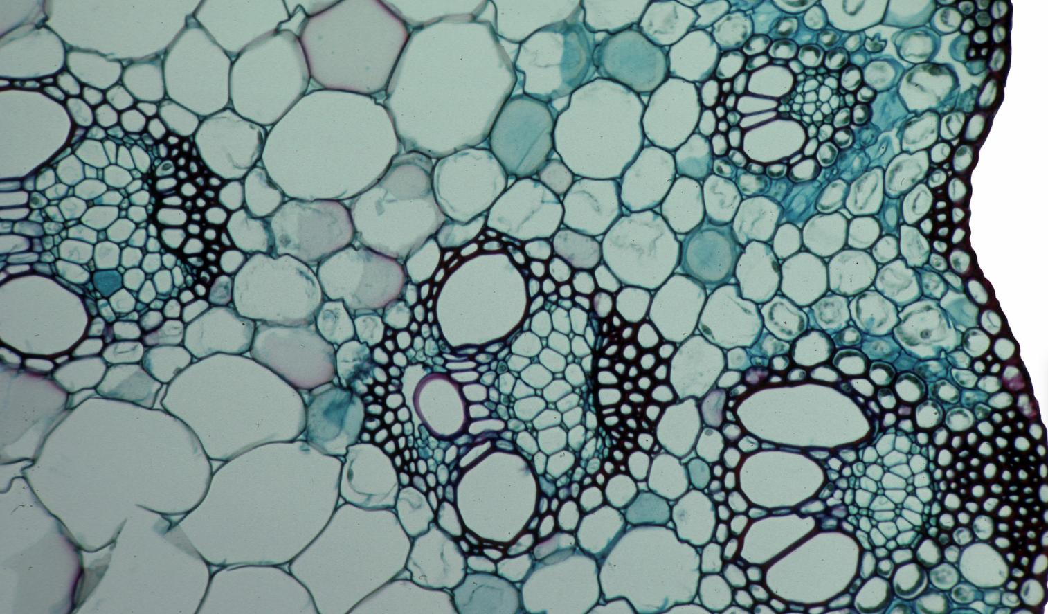 伟大妈妈生出9斤孩子，会阴却裂伤严重！妇产科医生：3招可预防