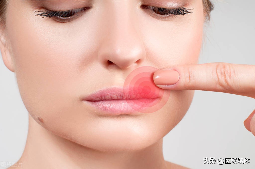 嘴角老是起泡,嘴角总是起泡是缺维生素吗