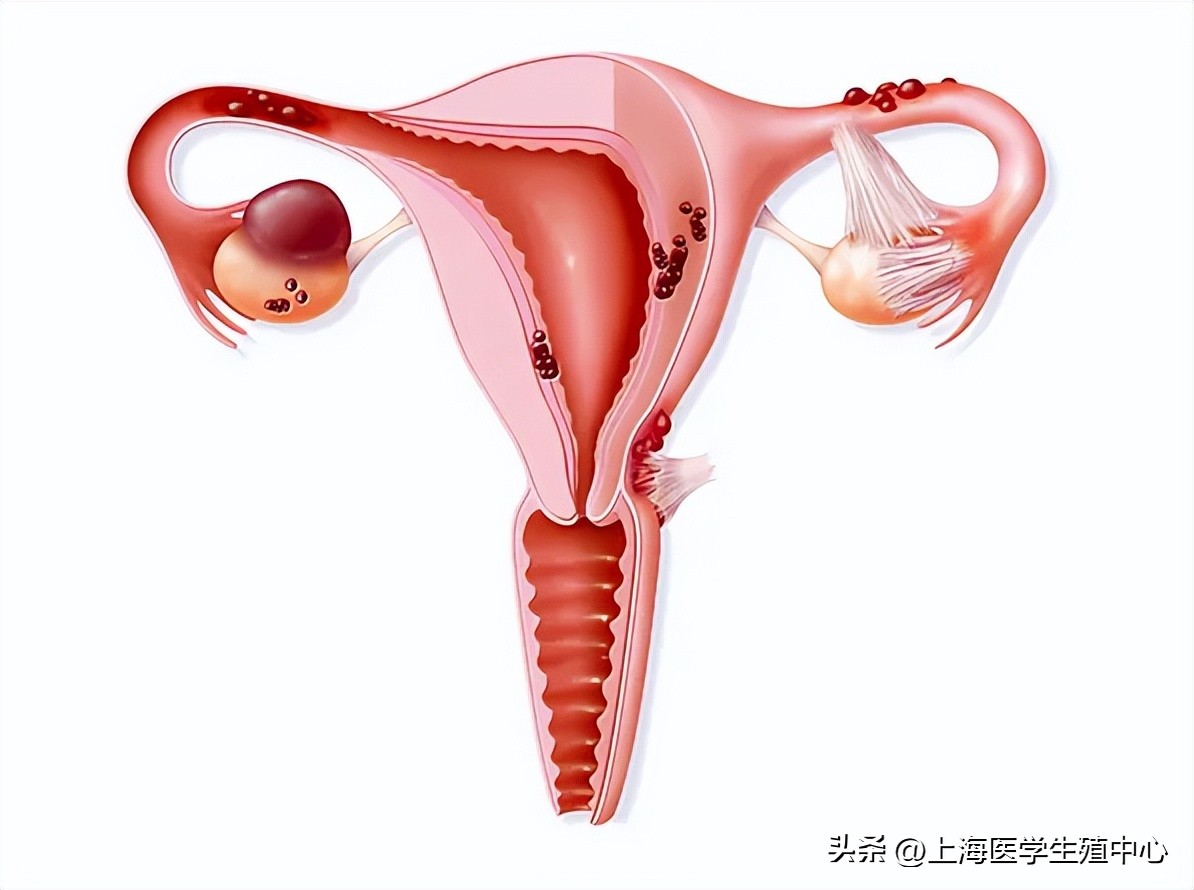 明明有排卵为什么会不孕,明明有排卵为什么怀不上