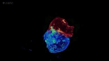 有没有治疗中晚期肝癌的好方法,治疗晚期肝癌最新办法