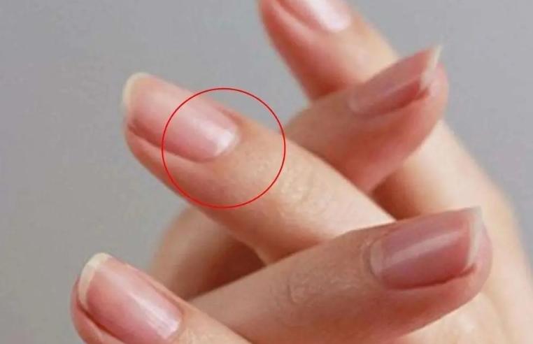 指甲如何看气血不足,怎么通过指甲判断气血不足
