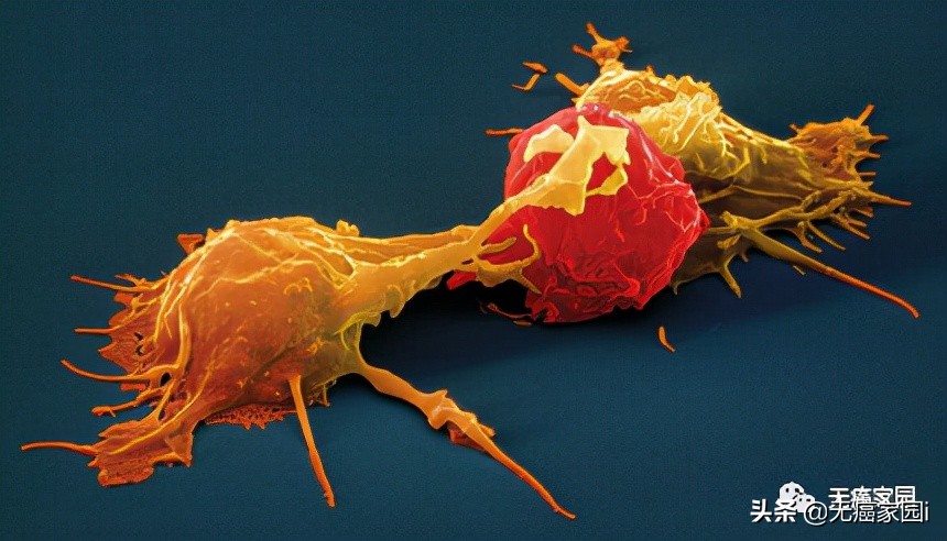 nk自然杀伤细胞治疗肿瘤效果,nk细胞治疗新突破