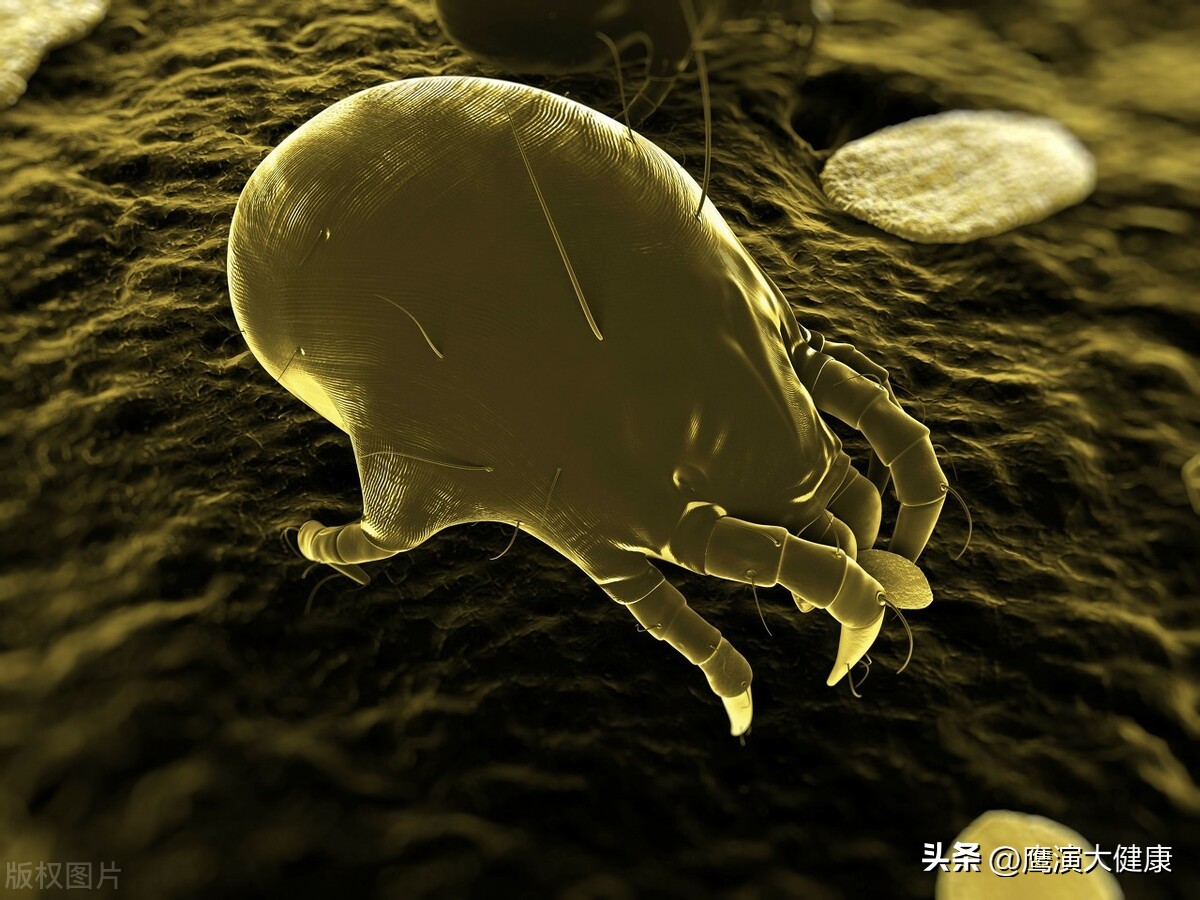 头皮上抠下来的白泥是螨虫吗,头皮上抠下来白泥是什么