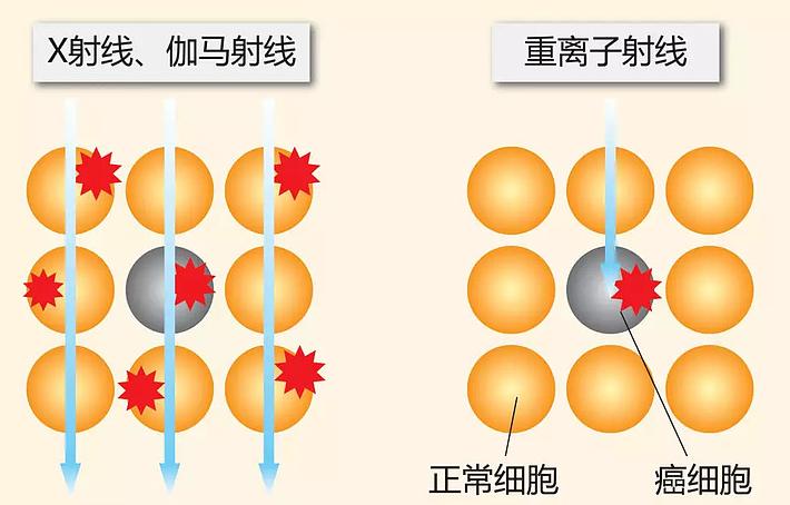 核辐射死掉了多少人,核辐射死亡真实事情