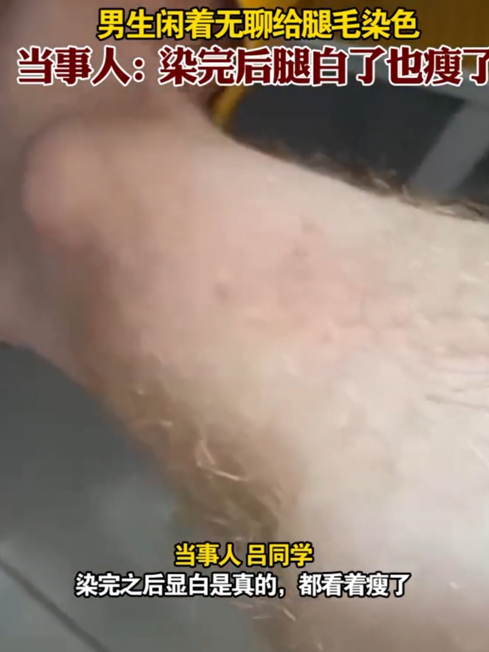 腿毛染什么颜色显白,男大学生上网课