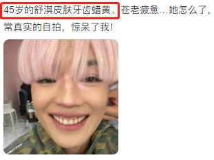 吴宣仪大龅牙,吴宣仪牙不修复吗