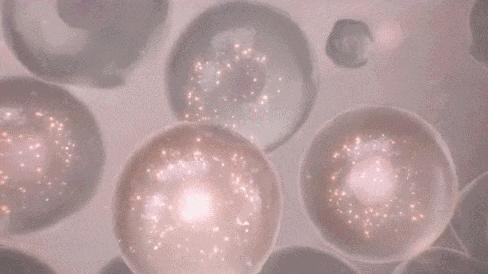 外阴白斑一般发病率多少,外阴白斑的病因