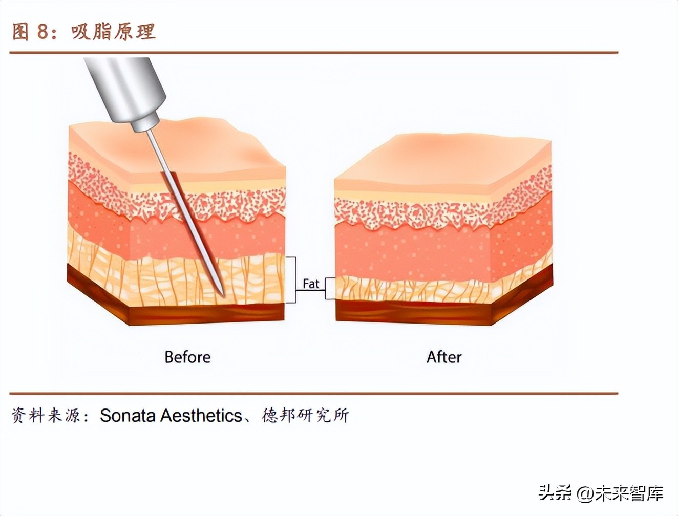 医美行业深度研究,医美瘦身行业