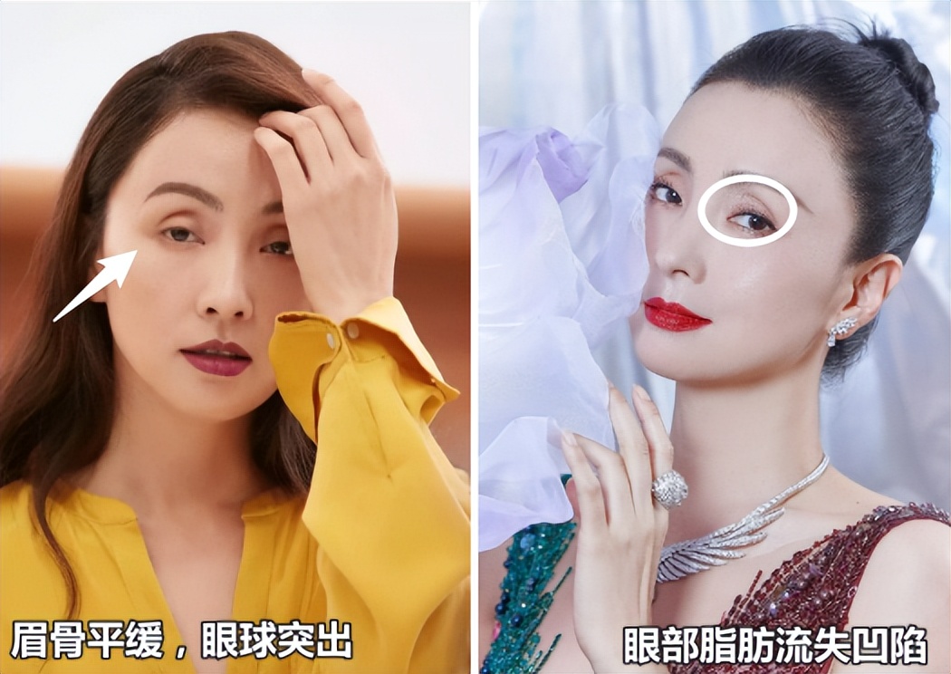 眼窝深邃和眼窝凹陷的区别,为什么眼窝凹陷眉骨颧骨都凸起