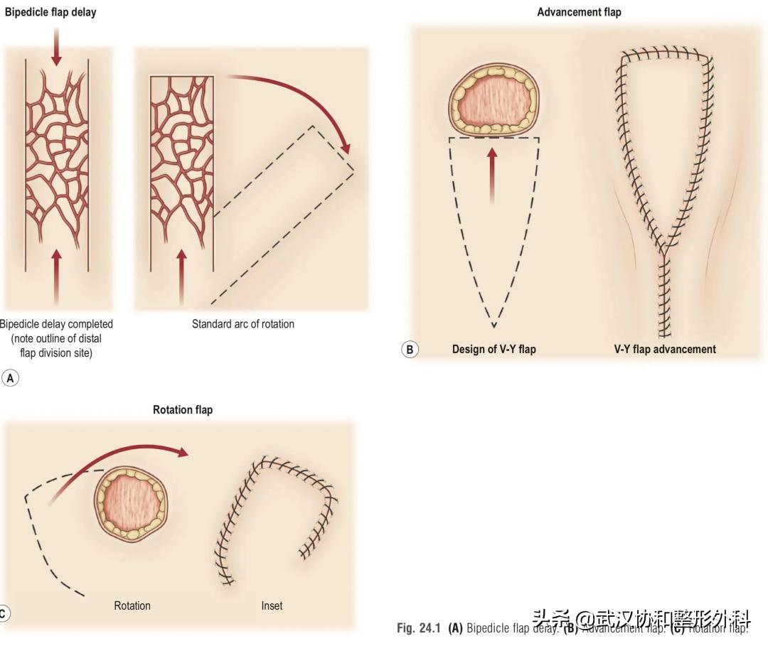 熊猫很漂亮但是很害羞,萌宝大熊猫的痣是天生的吗