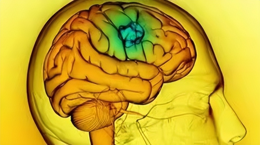 儿童患上脑肿瘤怎么办？这3种常见的治疗方法，可供家长选择