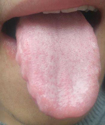 失眠4种中成药解决你的睡眠难题,失眠彻底治愈的七大方法