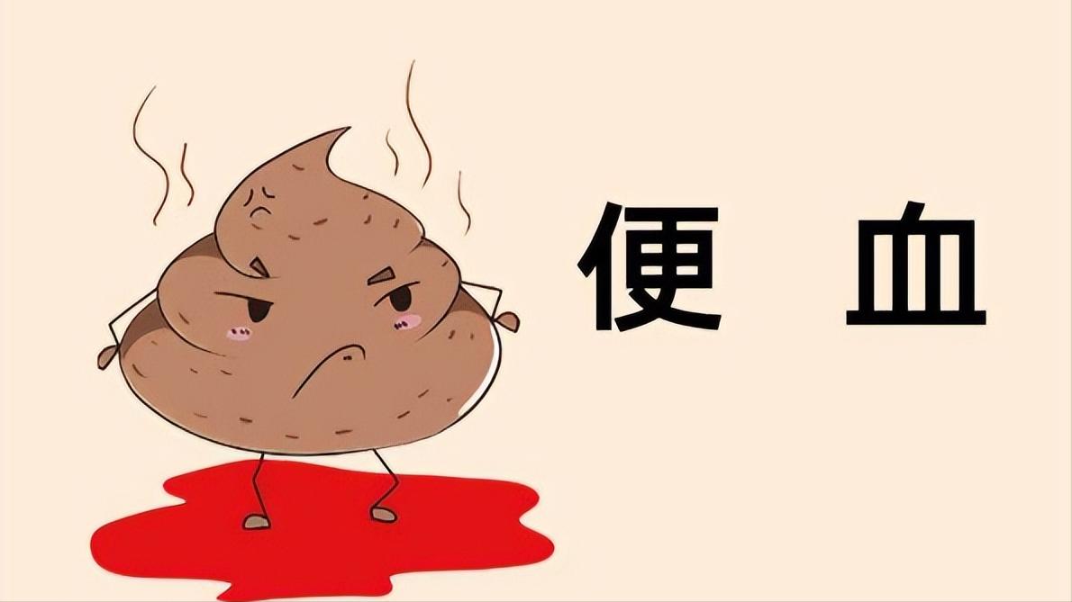 女性哪些生活习惯会引发肛裂,18岁女孩肛裂是什么毛病引起的