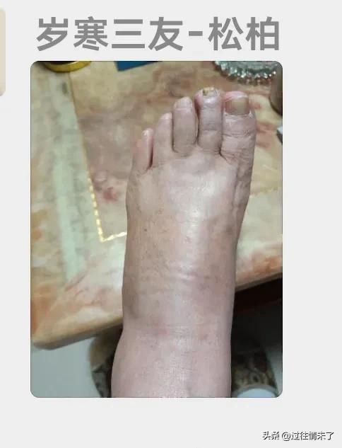 北京的大医院治不好一个脚疼脚肿大家怎么想？