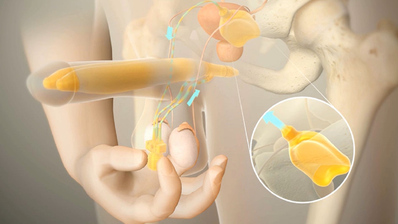 长期用伟哥有副作用吗,长期使用伟哥会有什么副作用
