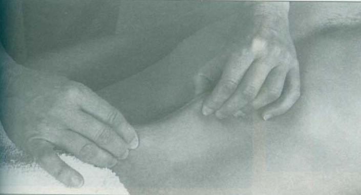 瘢痕松解术操作手法,瘢痕松解法