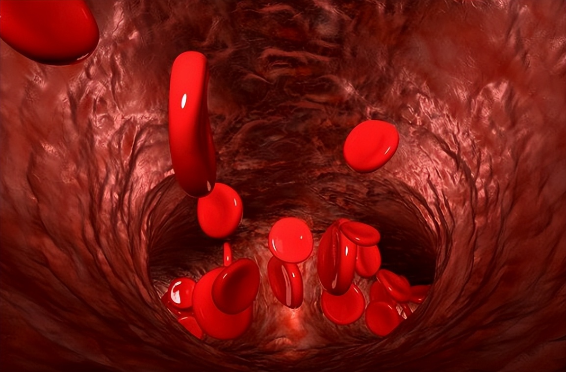 红酒泡洋葱能软化血管吗,红酒泡洋葱能否软化血管