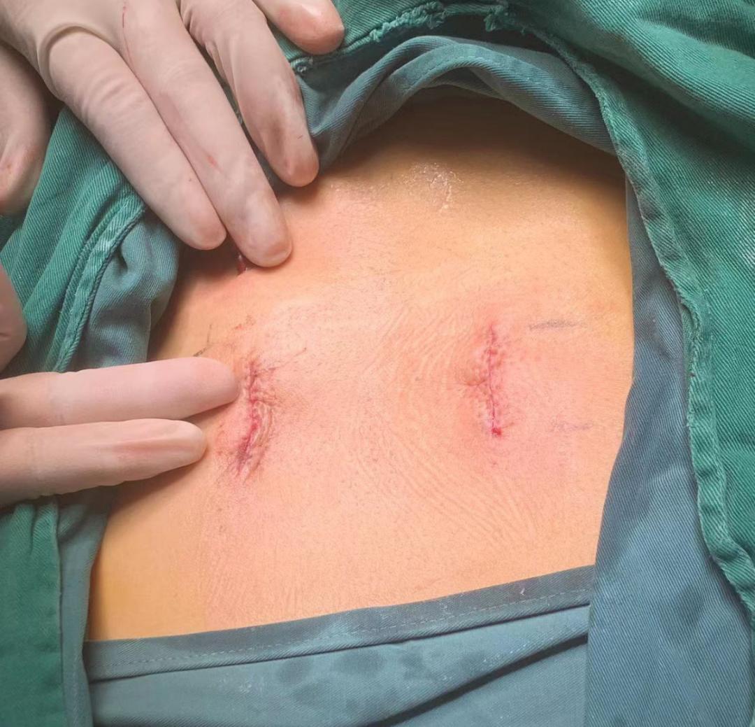 特色医疗技术为人民健康服务,开展新技术为患者带来新福祉