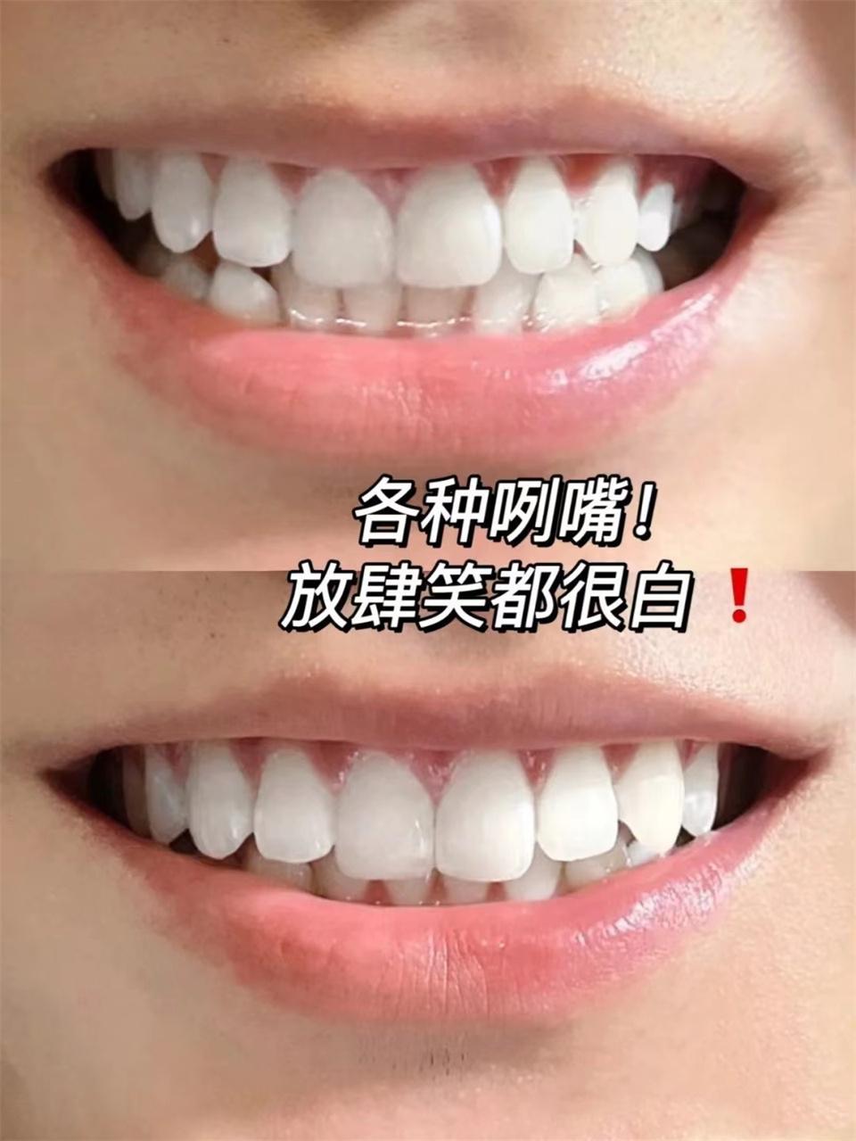 满嘴黑黝黝的牙渍、烟渍去不掉?掌握这几招,牙齿立刻亮白如新!