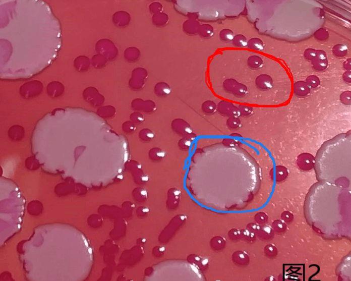 霉菌酵母菌检测方法视频,霉菌和酵母菌的国标检测方法