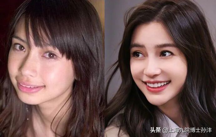 下巴对气质的影响,最好的下巴是双下巴吗