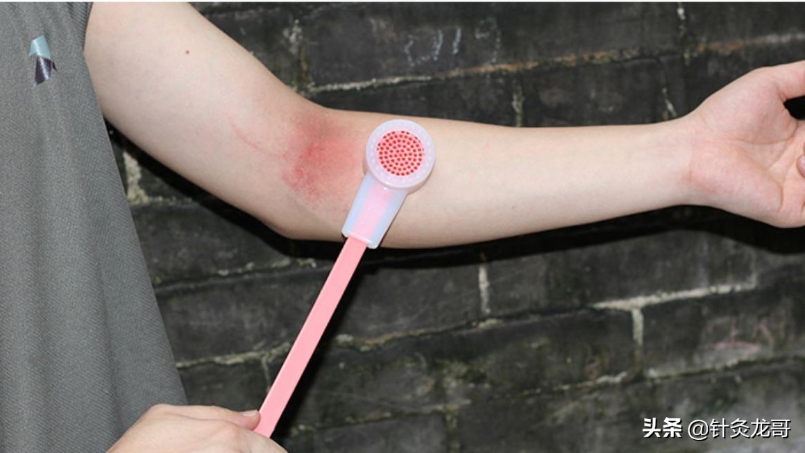 花甲偏瘫老人天天被打能治病？敲打经络降血压？莫让这些偏方害人