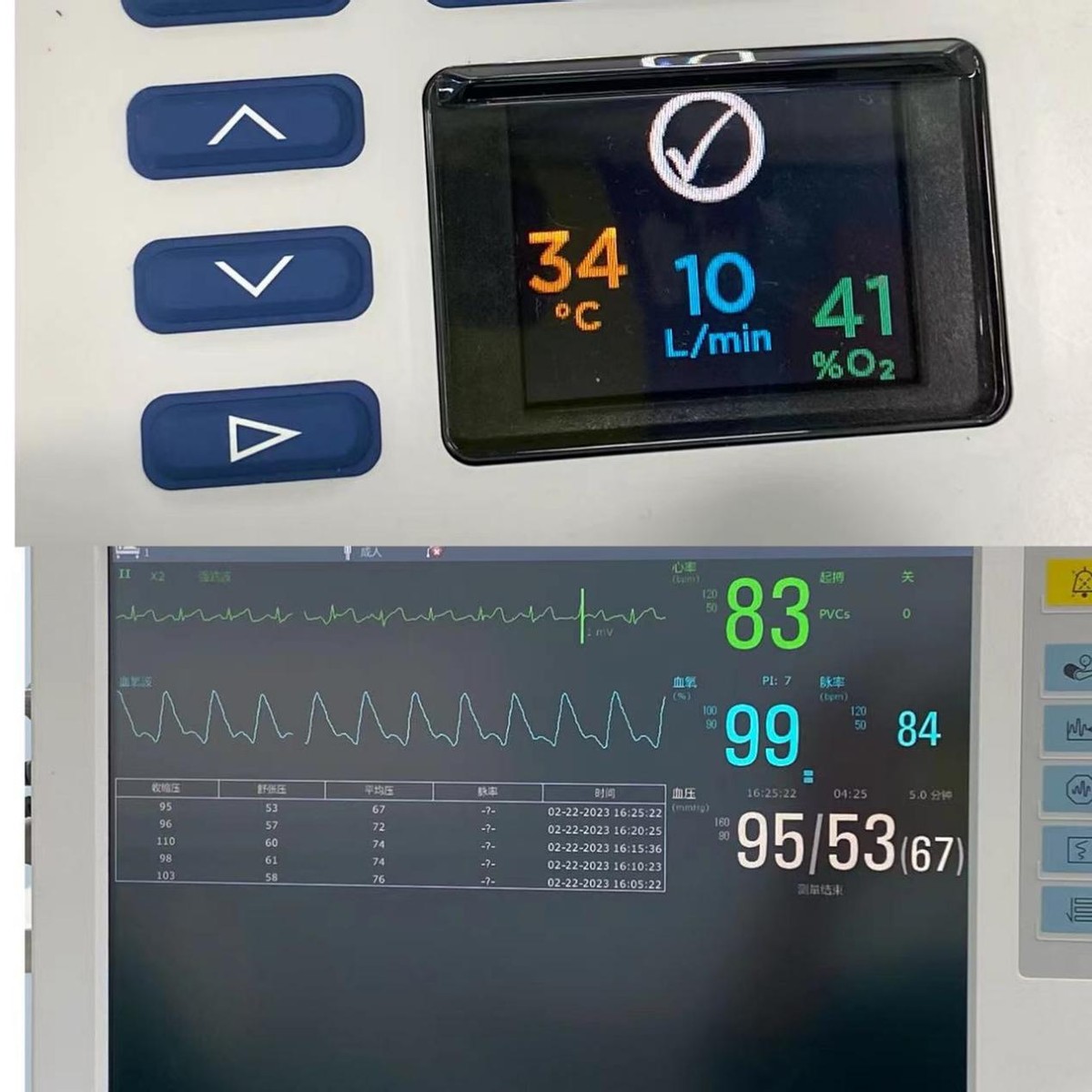高流量吸氧感受,高流量吸氧技术是什么