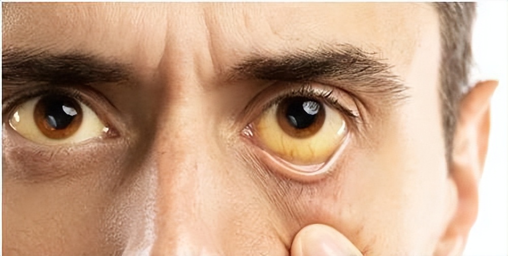 西药伤肝，这几味中草药也要慎用