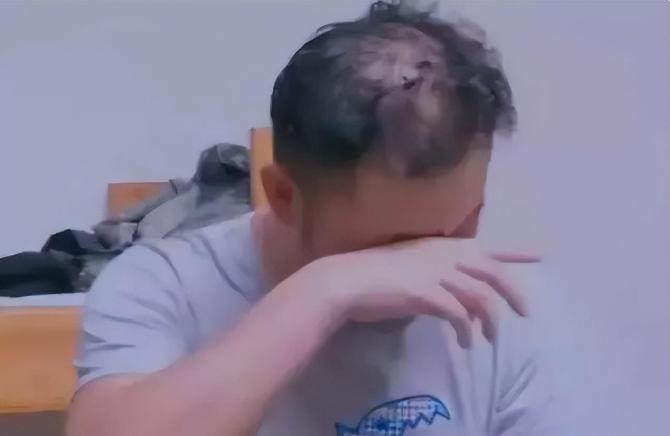 明星逃不过的脱发,明星也秃头还戴假发片