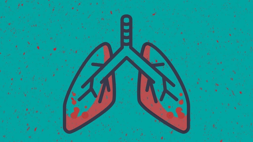 肺癌是发病率最高的恶性肿瘤,恶性程度比较高的肺癌