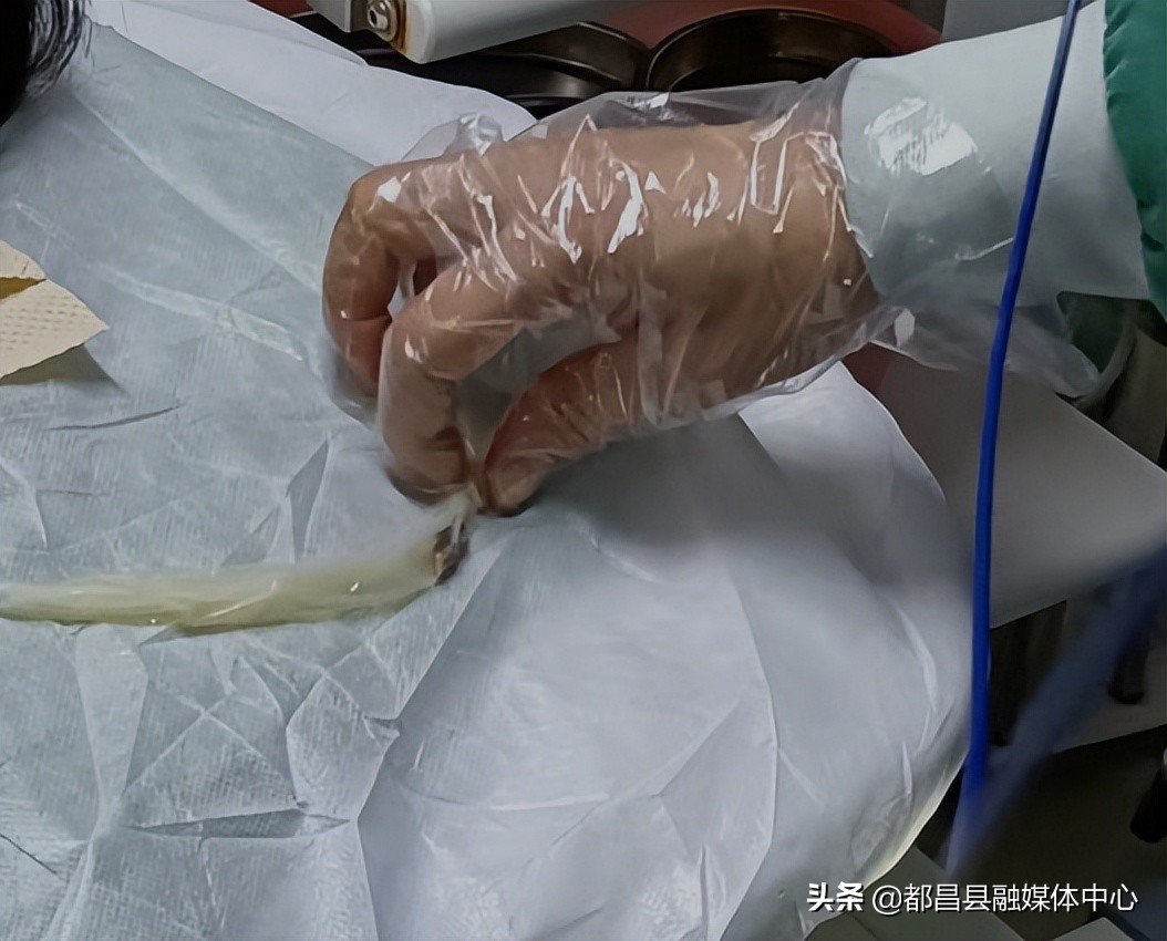 内镜安全套,医用内镜异物夹取器