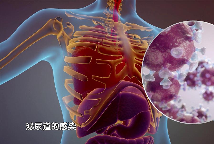 脑梗不用阿司匹林行不行,脑梗不用怕用它泡水服用