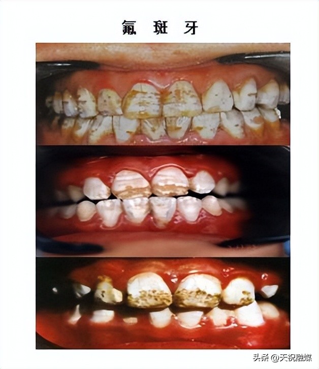 科普碳中和知识,氟元素科普