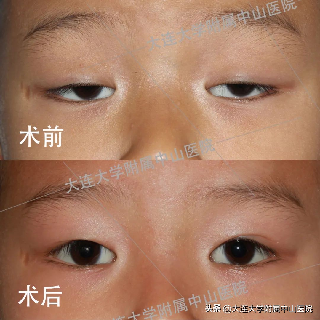 中山慈善万人行启动仪式,中山慈善现场直播