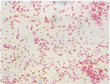 猪的巴氏杆菌病症状和治疗,猪的巴氏杆菌怎样才能彻底消灭