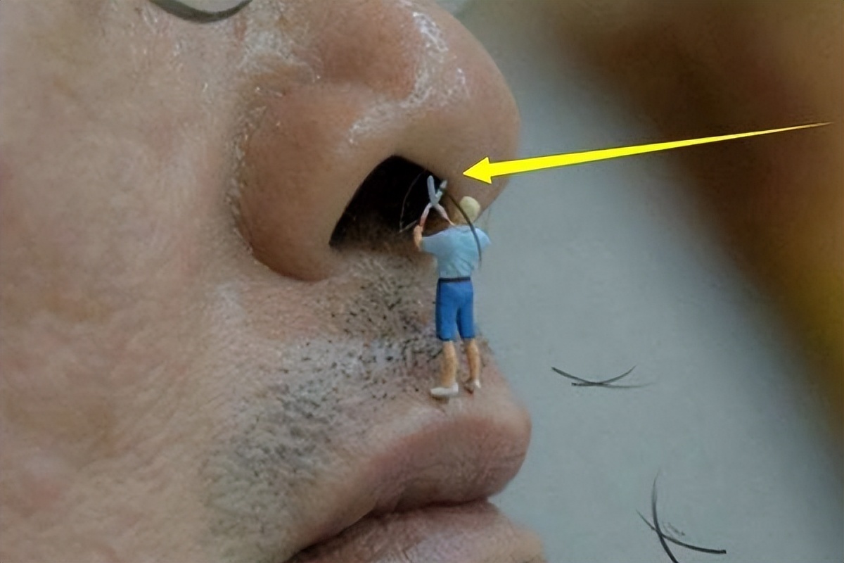 鼻毛窜出来跟什么有关,鼻毛窜出来的原因