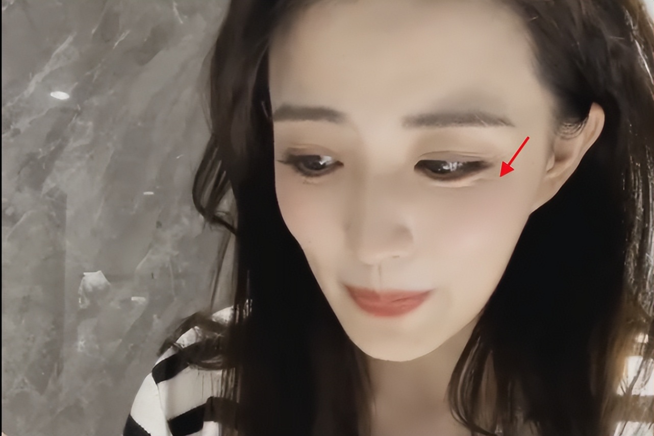 徐璐瘦的照片,徐璐抬头纹