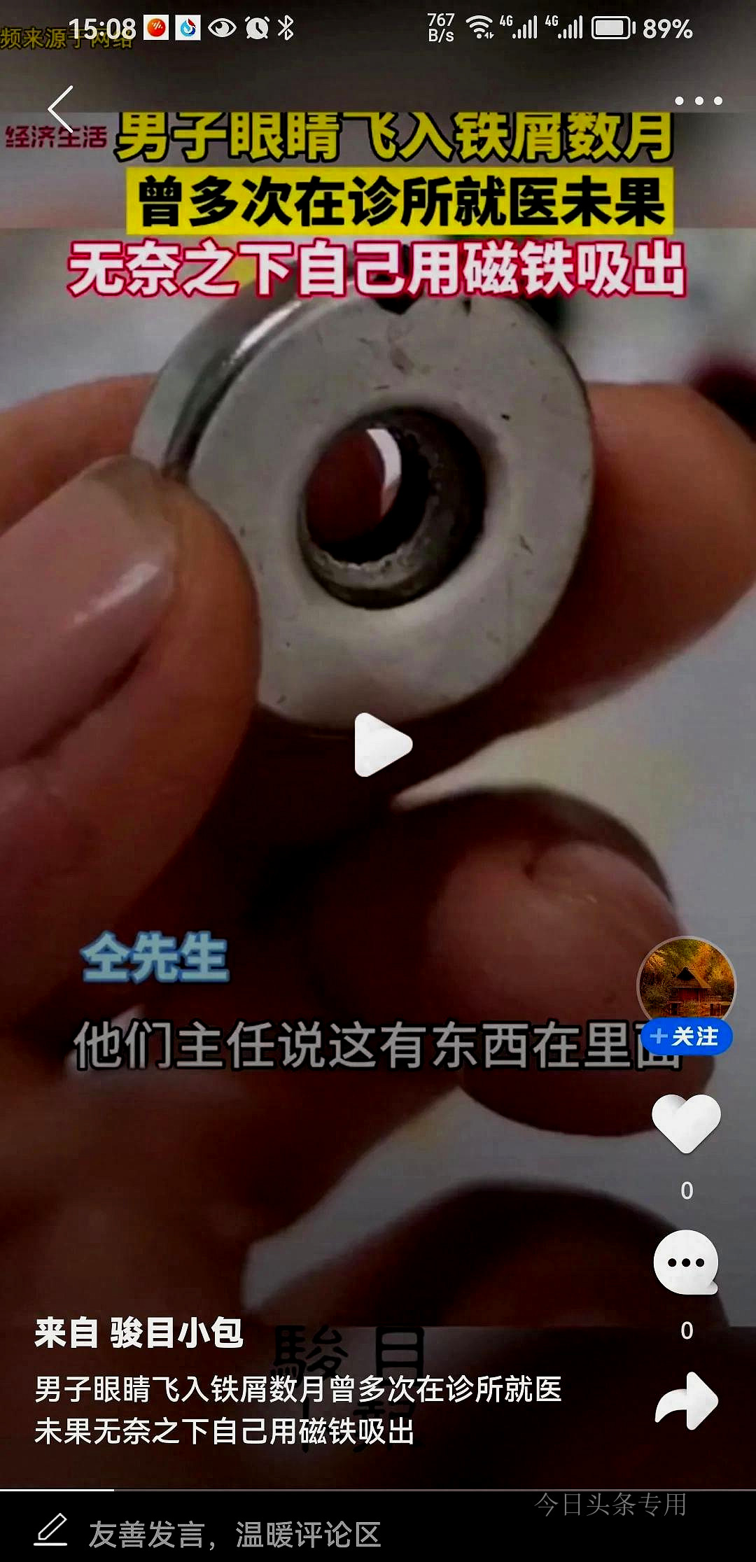 眼睛进了铁渣医生用针挑出来,眼睛里进铁渣处理后有后遗症