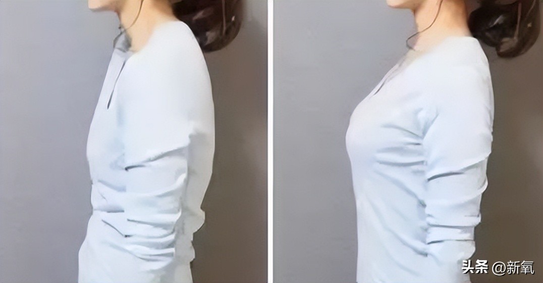 圆脸女明星拍照为什么没有双下巴,女明星圆肩对比