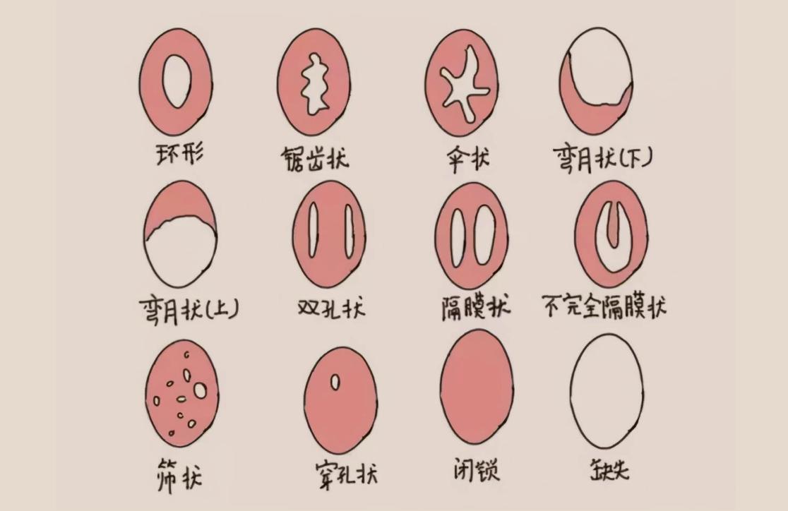 外阴总是很干怎么回事,外阴老是干是怎么回事