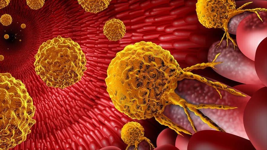 质子重离子治疗效果真有那么好吗,质子重离子治疗亲身经历