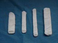 肱骨骨折取钢板怎样恢复,肱骨近端骨折切开复位内固定术