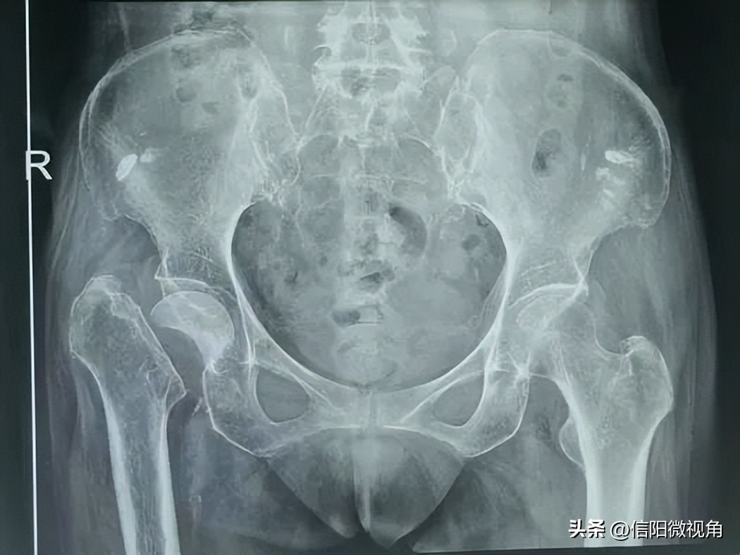 六旬老人被送医救治急寻亲属,六旬老人在信阳被送医治疗