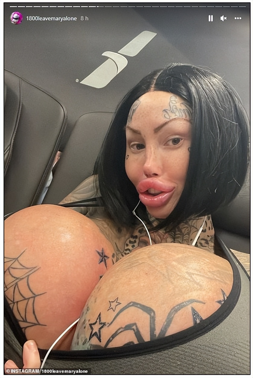 画面太辣眼...网红沉迷整形，因10公斤“假乳”被赶下飞机