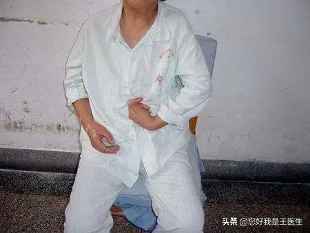 手指怎么测可以看出有没有得脑梗,手诊看掌纹