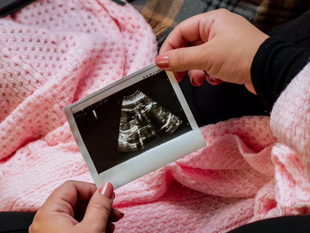 孕检最全注意事项，为爱的人收藏