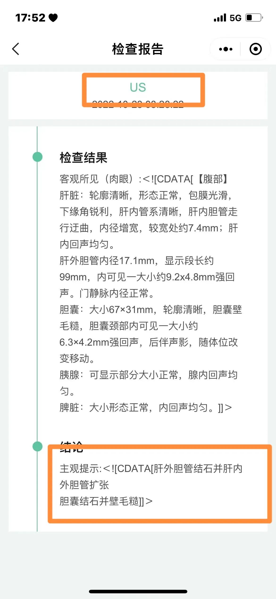 上火会导致尿液发黄吗,小便发黄是身体里排毒吗