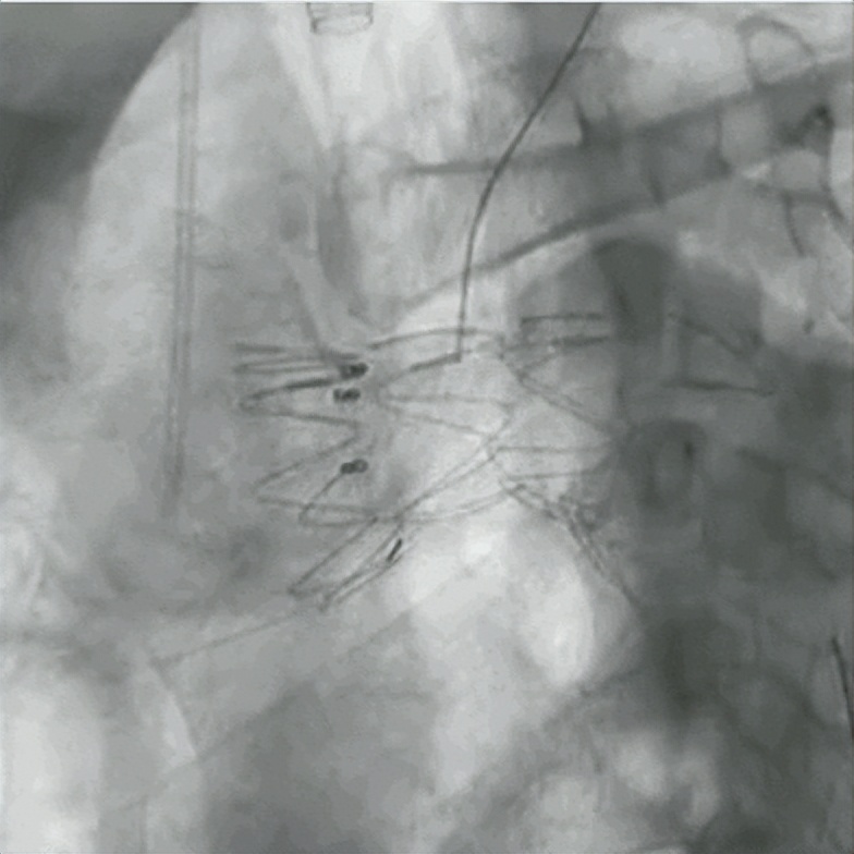 唐俊医生,介入治疗肿瘤唐医生